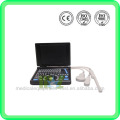 Escáner de ultrasonido portátil MSLPU02